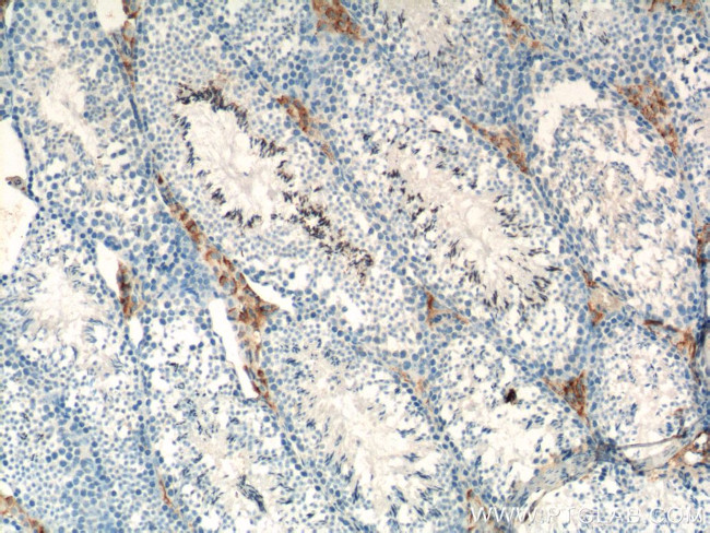 SLC35A1 Antibody in Immunohistochemistry (Paraffin) (IHC (P))