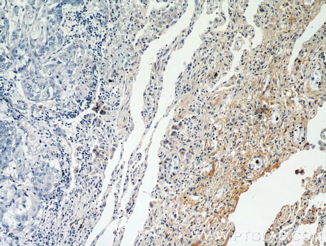 AGER Antibody in Immunohistochemistry (Paraffin) (IHC (P))