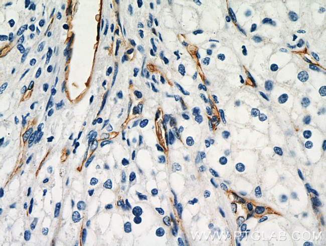 AGER Antibody in Immunohistochemistry (Paraffin) (IHC (P))