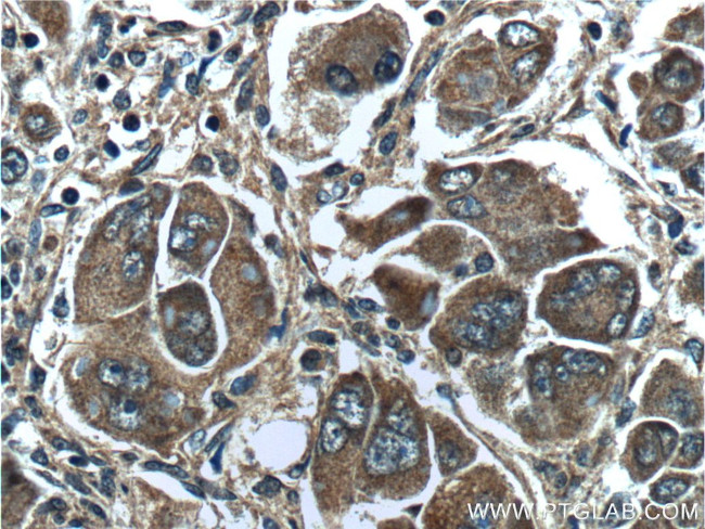 PAH Antibody in Immunohistochemistry (Paraffin) (IHC (P))