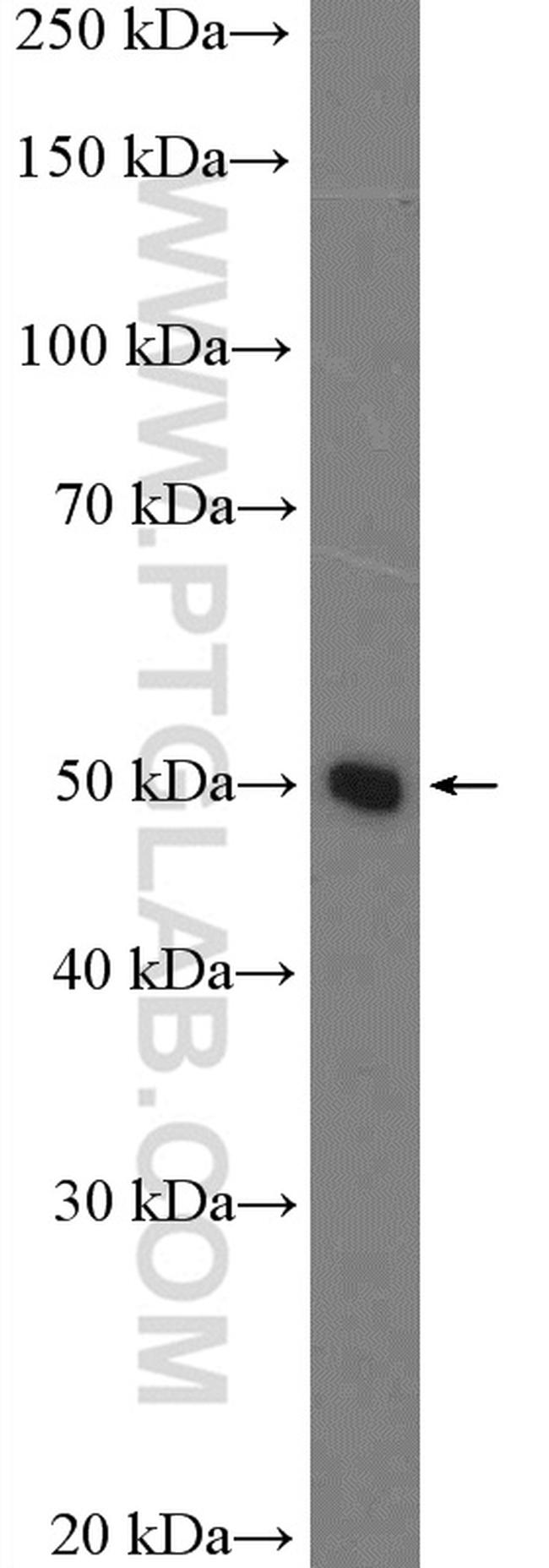 PAH Antibody in Western Blot (WB)