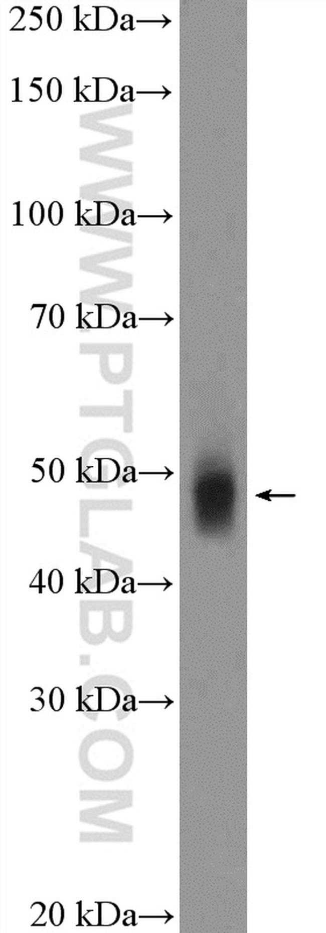 PAH Antibody in Western Blot (WB)