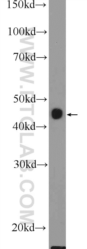 BHMT2 Antibody in Western Blot (WB)