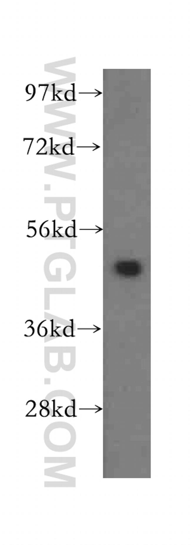 ADSS Antibody in Western Blot (WB)