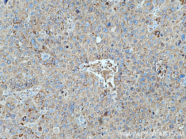 Alpha-1-Antitrypsin Antibody in Immunohistochemistry (Paraffin) (IHC (P))