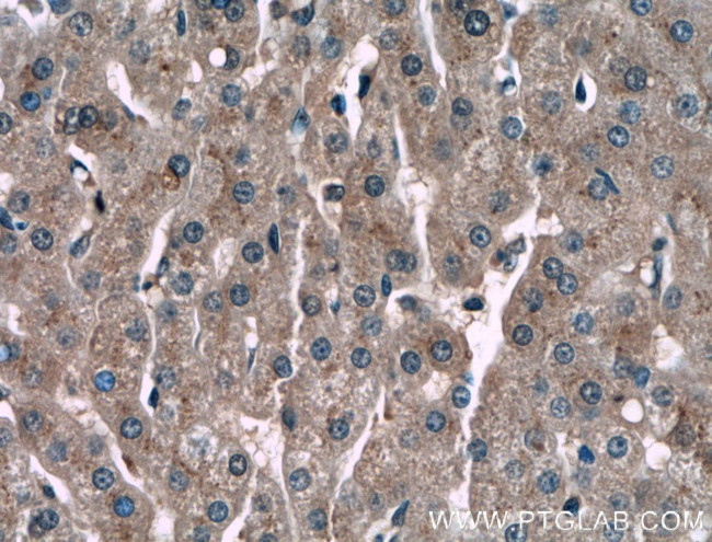 Alpha-1-Antitrypsin Antibody in Immunohistochemistry (Paraffin) (IHC (P))