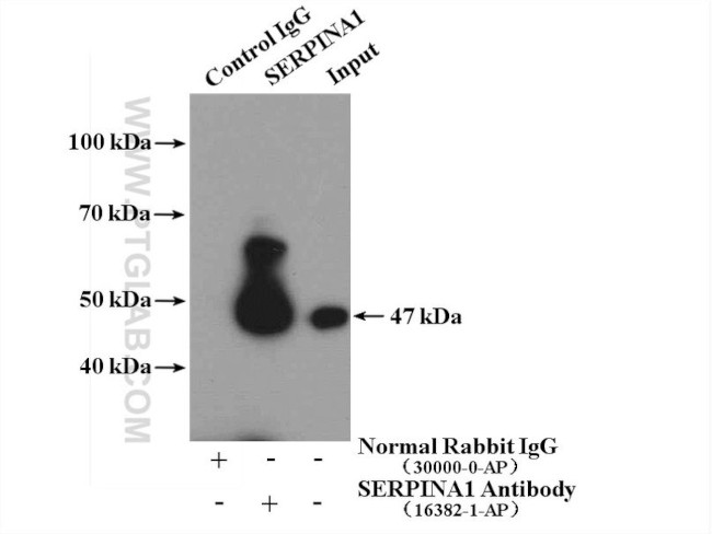 Alpha-1-Antitrypsin Antibody in Immunoprecipitation (IP)