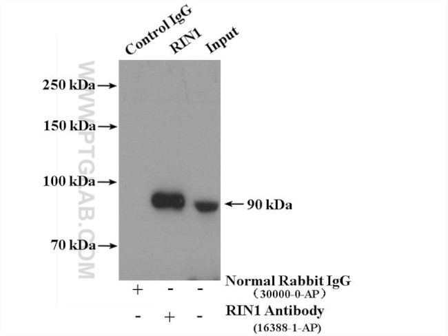 RIN1 Antibody in Immunoprecipitation (IP)