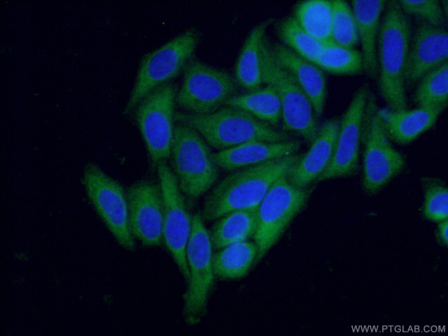 NRF2/NFE2L2 Antibody in Immunocytochemistry (ICC/IF)