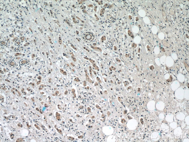 NRF2/NFE2L2 Antibody in Immunohistochemistry (Paraffin) (IHC (P))