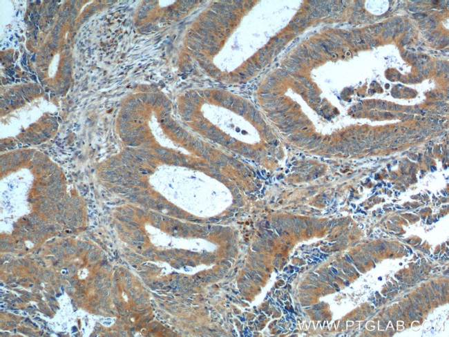 NRF2/NFE2L2 Antibody in Immunohistochemistry (Paraffin) (IHC (P))