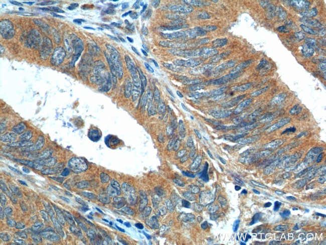 NRF2/NFE2L2 Antibody in Immunohistochemistry (Paraffin) (IHC (P))