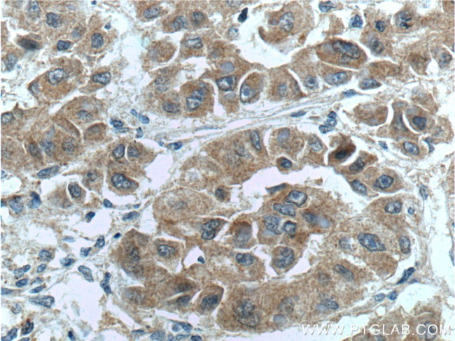 NRF2/NFE2L2 Antibody in Immunohistochemistry (Paraffin) (IHC (P))