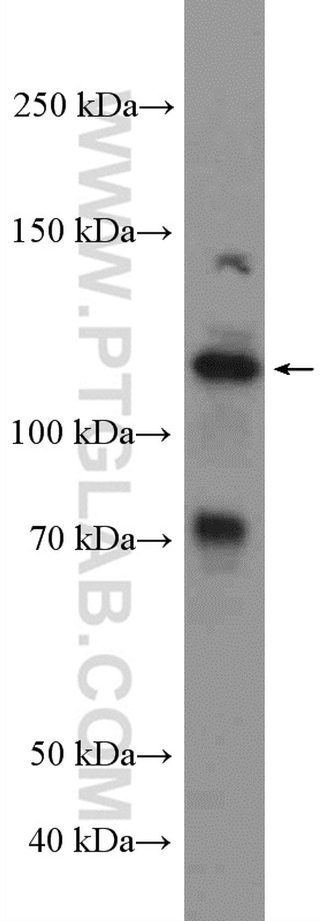 NRF2/NFE2L2 Antibody in Western Blot (WB)