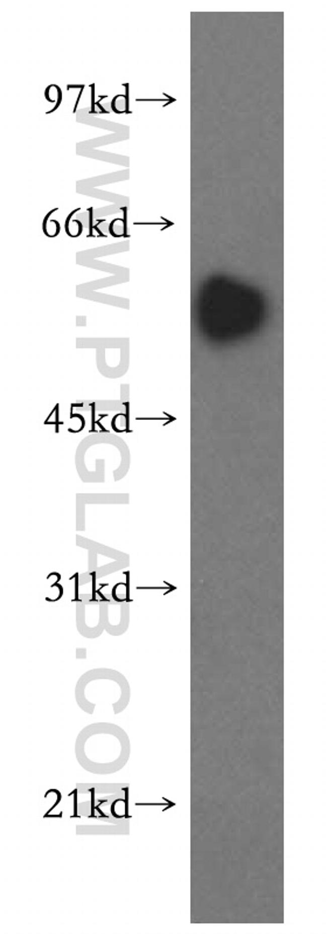 SMAD9 Antibody in Western Blot (WB)