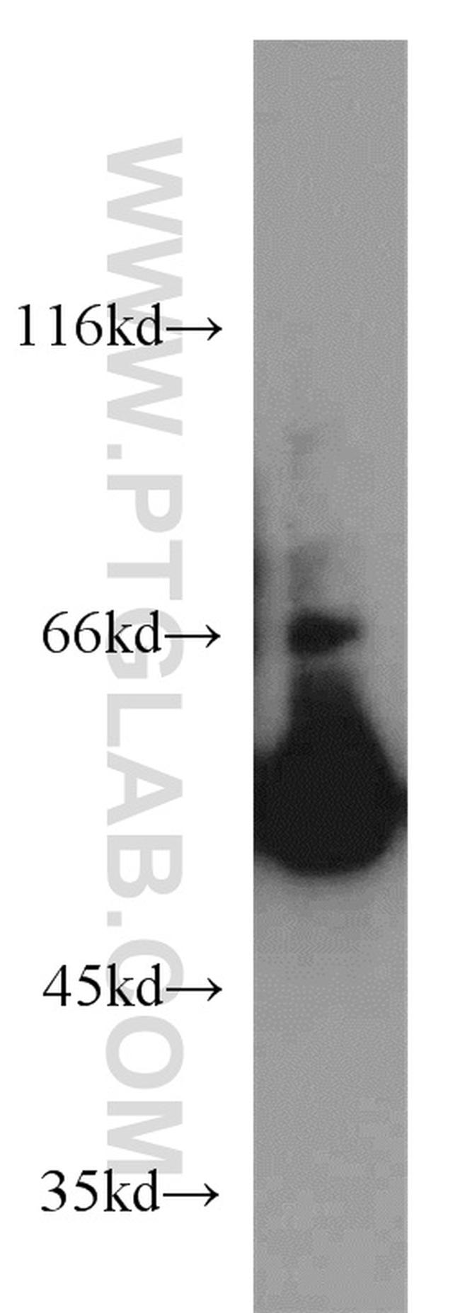 SMAD9 Antibody in Western Blot (WB)