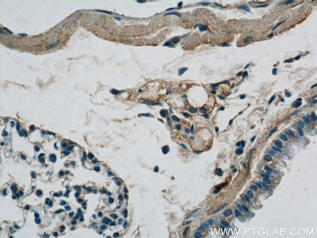 Biglycan Antibody in Immunohistochemistry (Paraffin) (IHC (P))