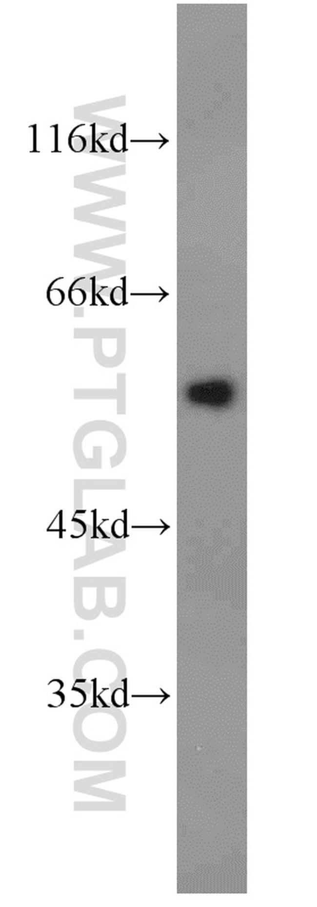 Antithrombin III Antibody in Western Blot (WB)