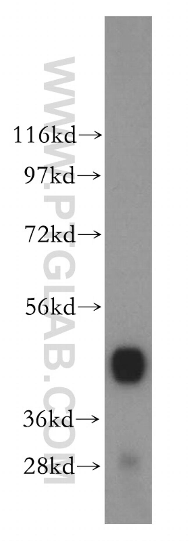 ENO3 Antibody in Western Blot (WB)