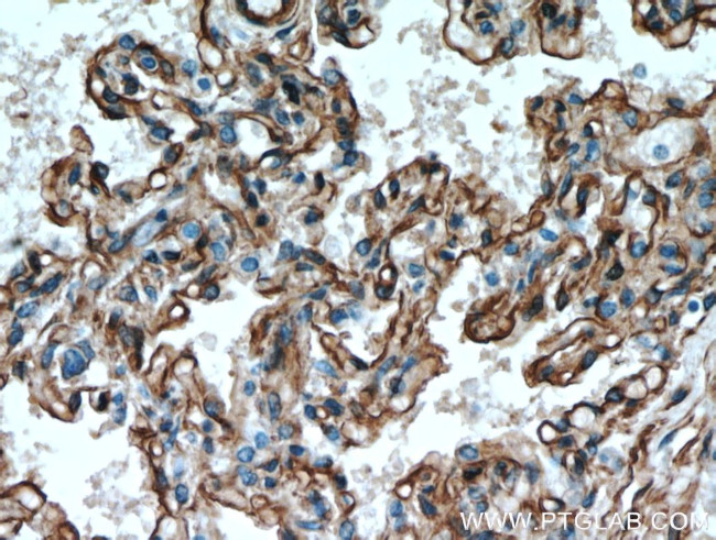 Caveolin-1 Antibody in Immunohistochemistry (Paraffin) (IHC (P))