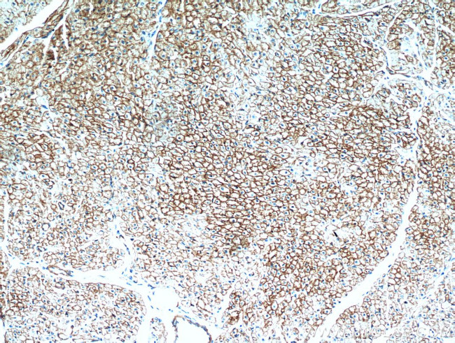 Caveolin-1 Antibody in Immunohistochemistry (Paraffin) (IHC (P))