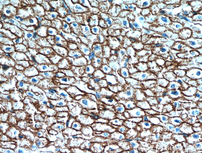 Caveolin-1 Antibody in Immunohistochemistry (Paraffin) (IHC (P))