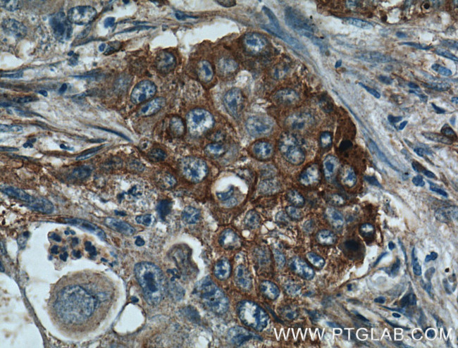 Caveolin-1 Antibody in Immunohistochemistry (Paraffin) (IHC (P))