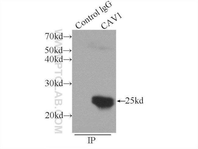 Caveolin-1 Antibody in Immunoprecipitation (IP)