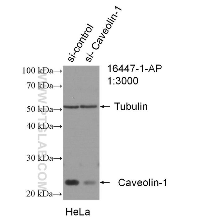 Caveolin-1 Antibody in Western Blot (WB)