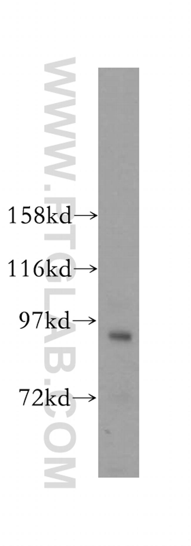 MCM8 Antibody in Western Blot (WB)