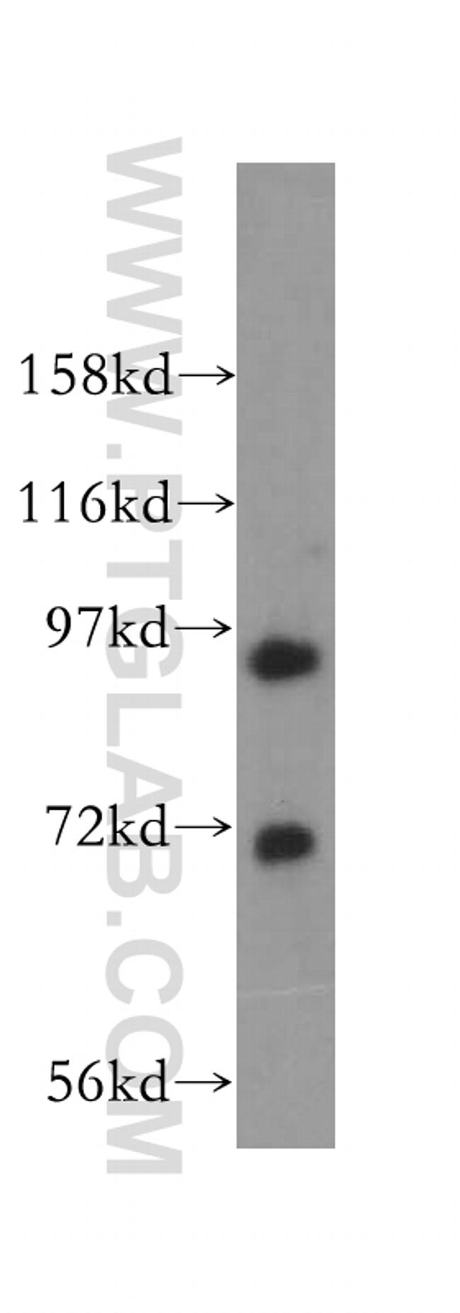 MCM8 Antibody in Western Blot (WB)