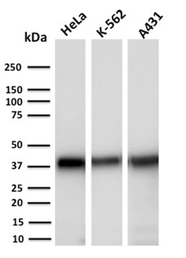 Aldo-keto Reductase Family 1 Member C2/DD2 Antibody in Western Blot (WB)