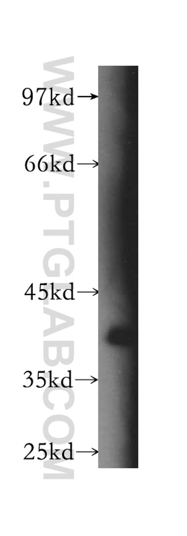 BPNT1 Antibody in Western Blot (WB)