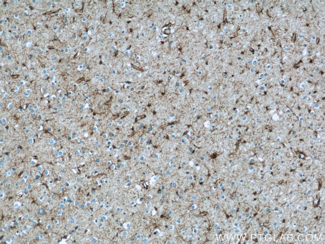 Aquaporin 4 Antibody in Immunohistochemistry (Paraffin) (IHC (P))