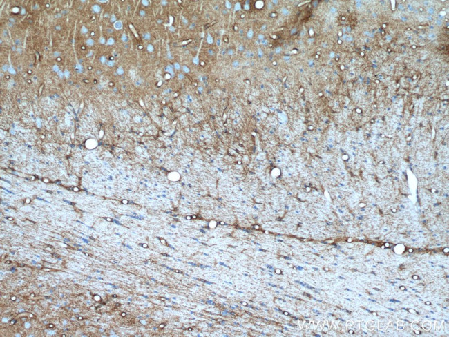 Aquaporin 4 Antibody in Immunohistochemistry (Paraffin) (IHC (P))