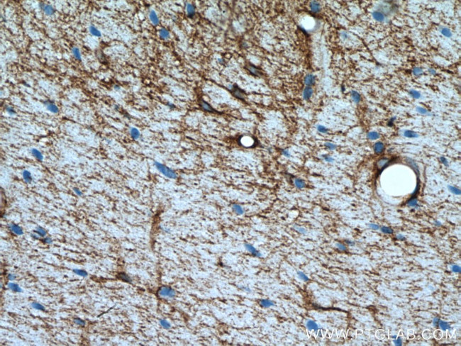 Aquaporin 4 Antibody in Immunohistochemistry (Paraffin) (IHC (P))