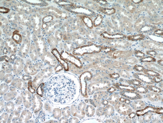 Aquaporin 4 Antibody in Immunohistochemistry (Paraffin) (IHC (P))