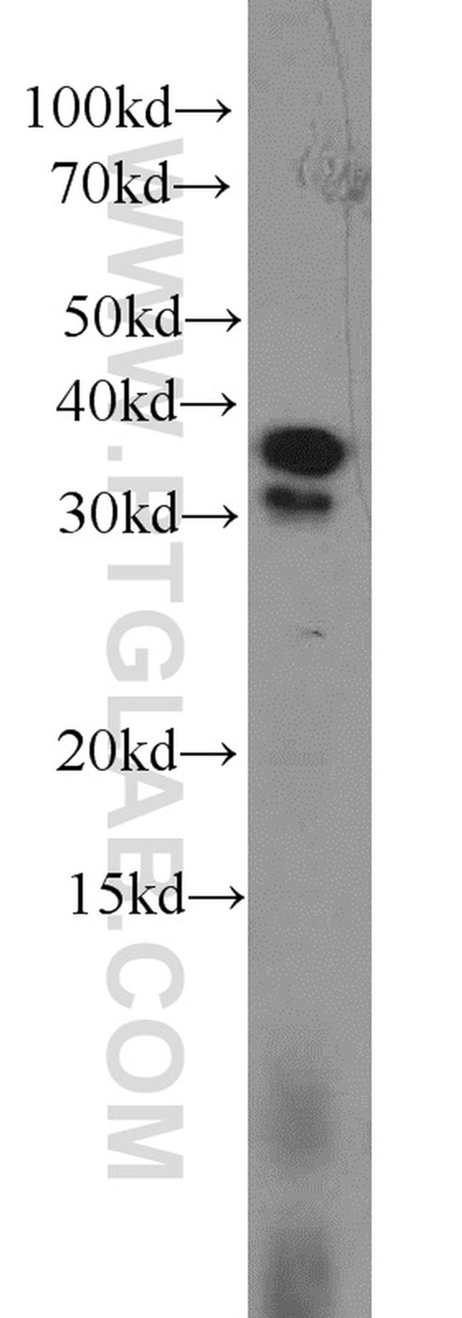 Aquaporin 4 Antibody in Western Blot (WB)