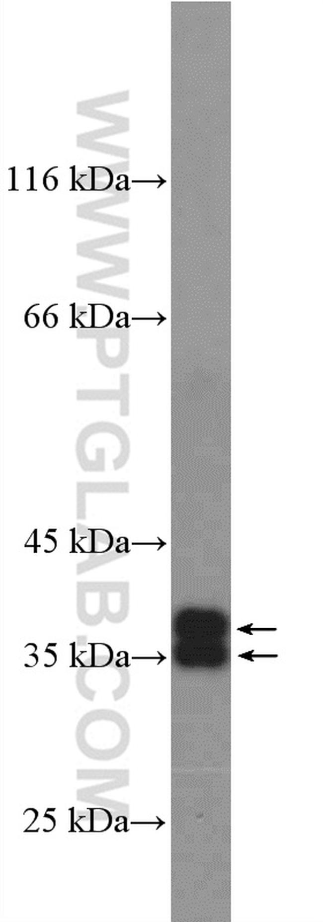 Aquaporin 4 Antibody in Western Blot (WB)