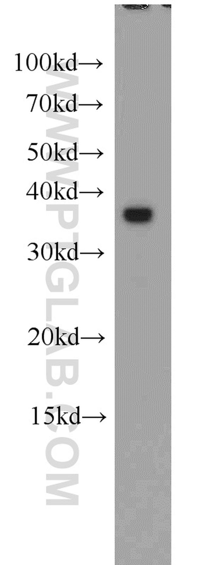 Aquaporin 4 Antibody in Western Blot (WB)