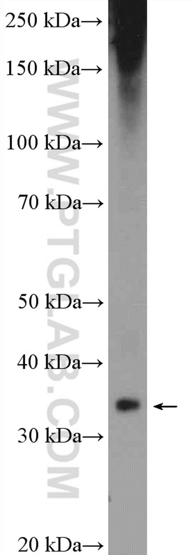 Aquaporin 4 Antibody in Western Blot (WB)