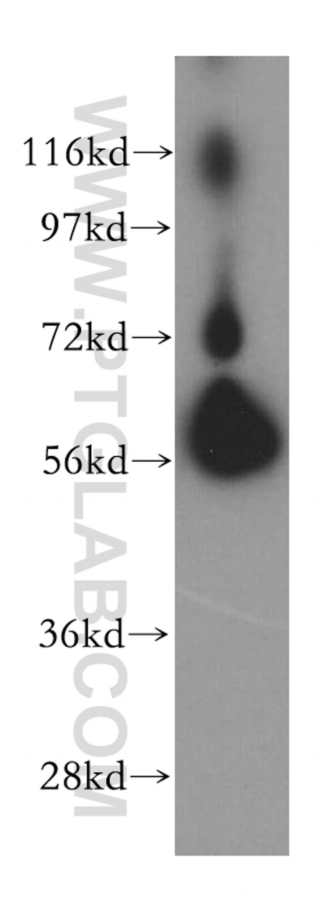 BTN2A2 Antibody in Western Blot (WB)