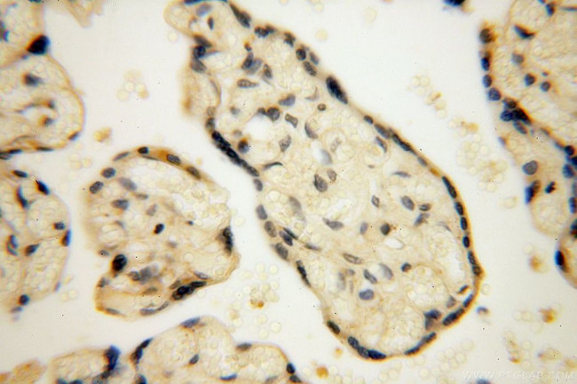 EDC3 Antibody in Immunohistochemistry (Paraffin) (IHC (P))