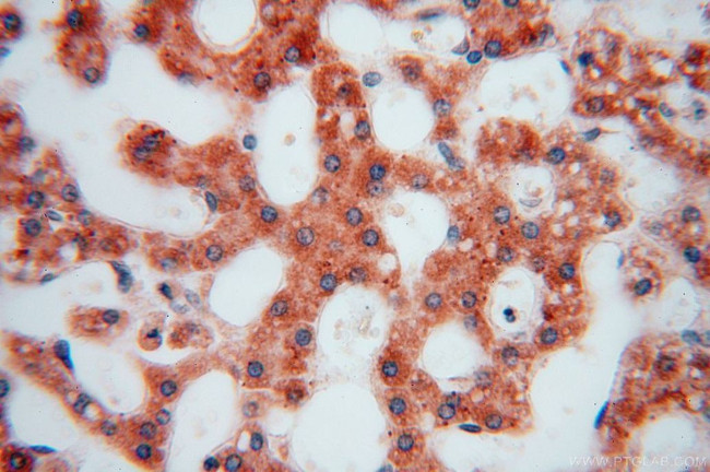 EDC3 Antibody in Immunohistochemistry (Paraffin) (IHC (P))