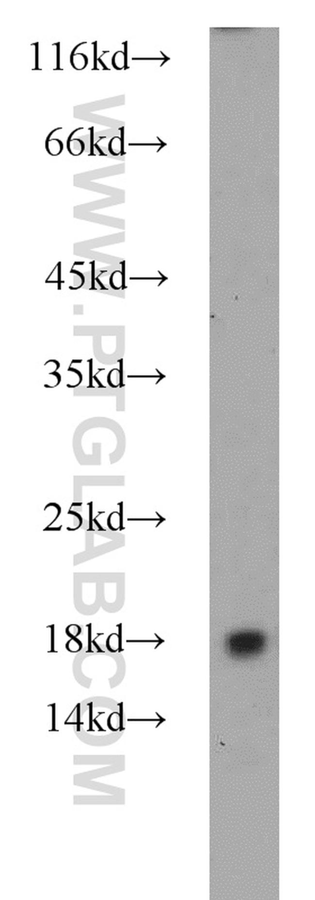 RPL31 Antibody in Western Blot (WB)