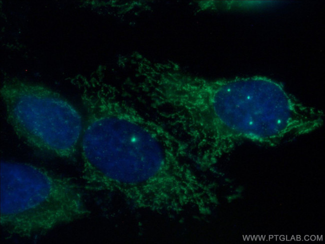 MCEE Antibody in Immunocytochemistry (ICC/IF)