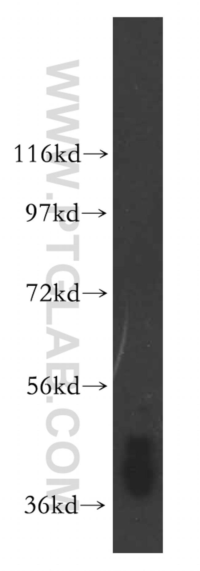 ARH3 Antibody in Western Blot (WB)