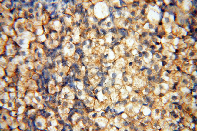 FBXL8 Antibody in Immunohistochemistry (Paraffin) (IHC (P))