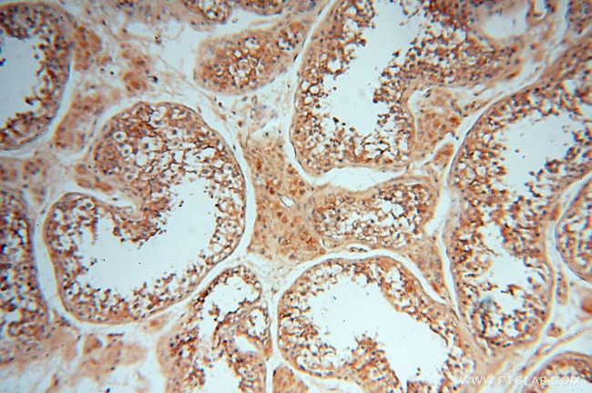 FBXL8 Antibody in Immunohistochemistry (Paraffin) (IHC (P))