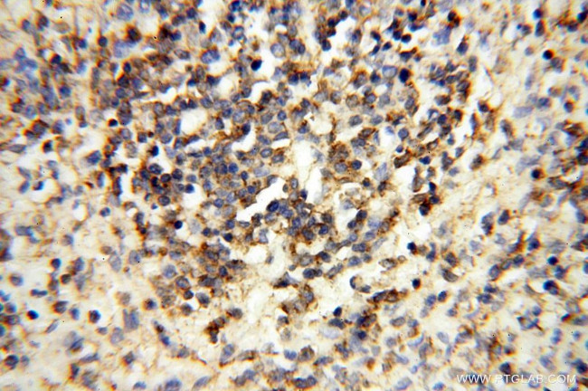 FBXL8 Antibody in Immunohistochemistry (Paraffin) (IHC (P))